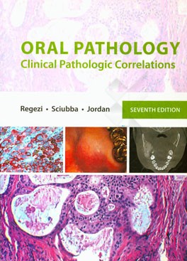 Oral pathology: clinical pathologic correlations