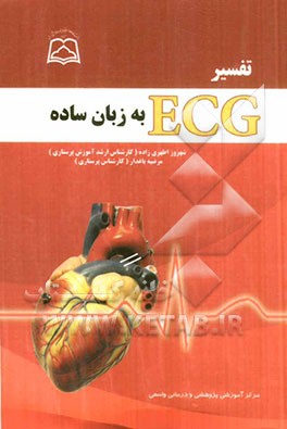 تفسیر ECG به زبان ساده