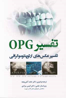 تفسیر OPG: تفسیر عکس های ارتوپنتوموگرافی