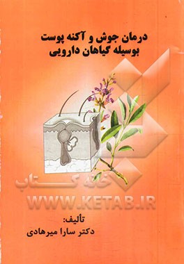 درمان جوش و آکنه پوست بوسیله گیاهان دارویی