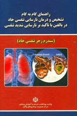 راهنمای گام به گام تشخیص و درمان نارسایی تنفسی حاد در بالغین با تاکید بر نارسایی شدید تنفسی (سندرم زجر تنفسی حاد)