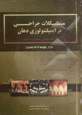 مشکلات جراحی در ایمپلنتولوژی دهان: علت شناسی، پیشگیری، درمان