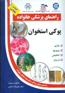 پوکی استخوان (اوستئوپورز)