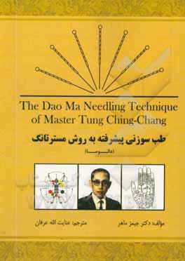 طب سوزنی پیشرفته به روش Master Tung: دائوما