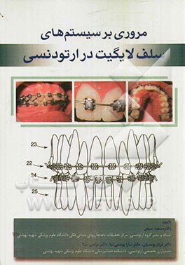 مروری بر سیستم های سلف لایگیت در ارتودنسی