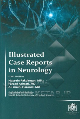 Illustrated case reports in Neurology