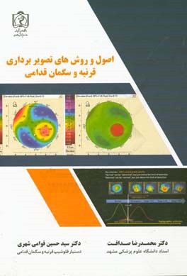 مروری بر اصول و روشهای تصویربرداری قرنیه و سگمان قدامی