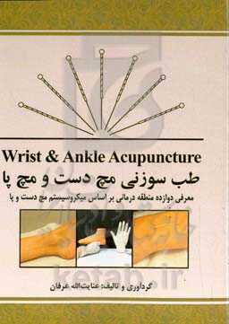 طب سوزنی مچ دست و مچ پا‏‫ = Wrist &amp; Ankle Acupuncture