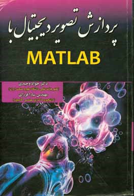 پردازش تصویر دیجیتال با Matlab