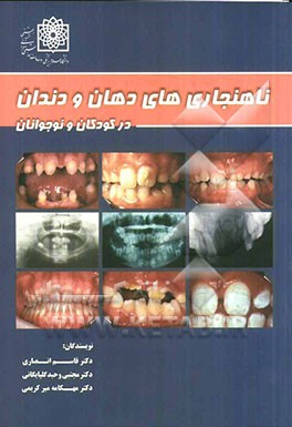 ناهنجاریهای دهان و دندان در کودکان و نوجوانان